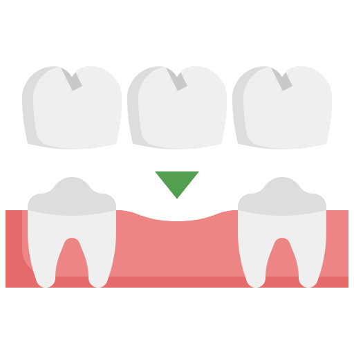 Crown & Bridge (FPD)