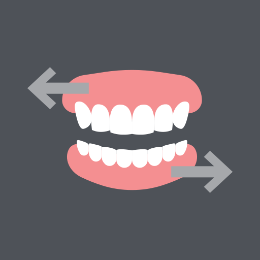 Full Mouth Rehabilitation