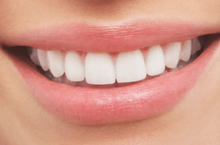 Aesthetic Dentistry 2