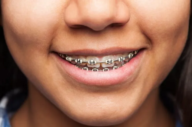 Orthodontic